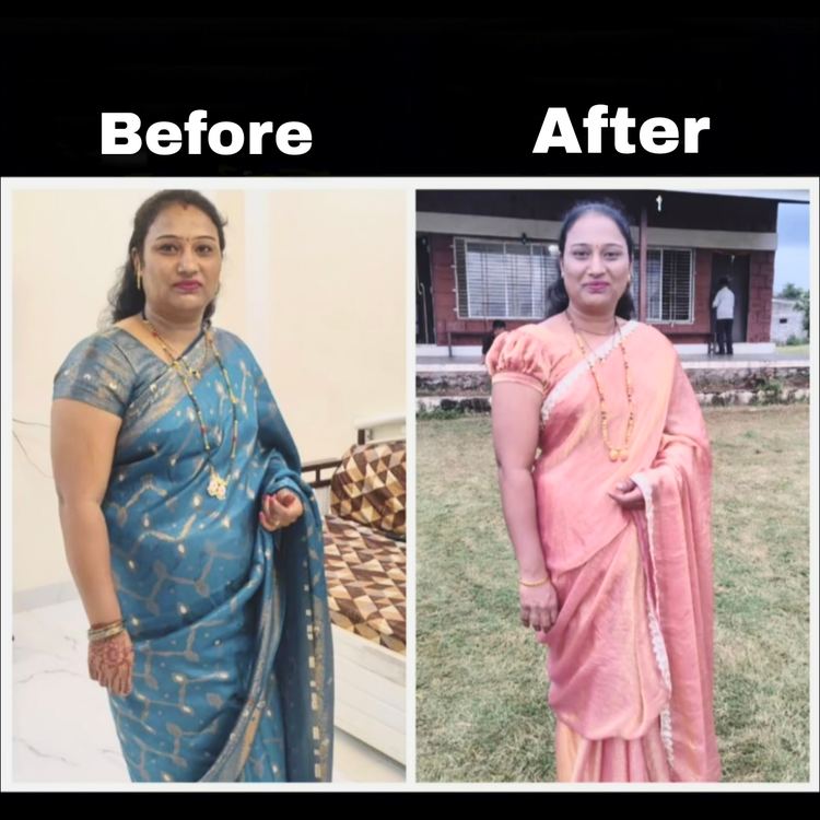 Member Transformation